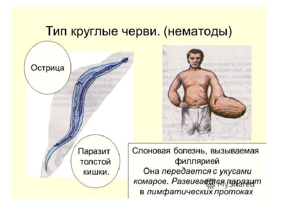 Проект на тему круглые черви