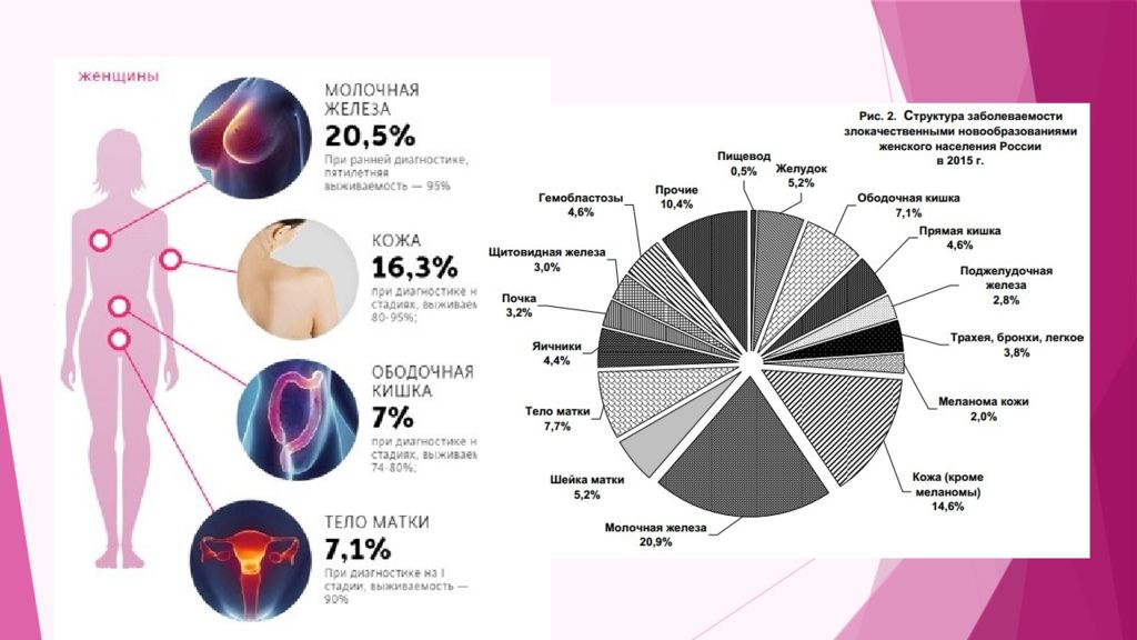Частота случаев заболеваний. Статистика заболеваний молочной железы. Злокачественные заболевания статистика. Статистика раковых заболеваний. Структура онкологических заболеваний у женщин.