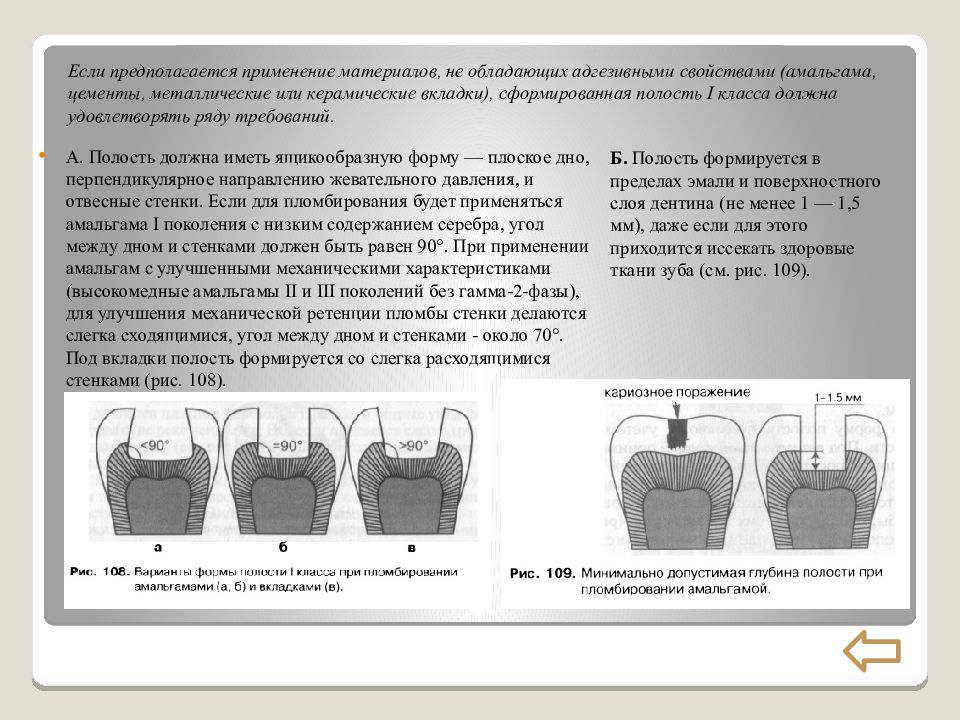 Пломбирование кариозных полостей v класса. Принципы препарирования под вкладки. Адгезивное препарирование принципы. Принципы препарирования кариозных полостей под вкладки. Кариозных полостей под вкладки. (I - V классов).