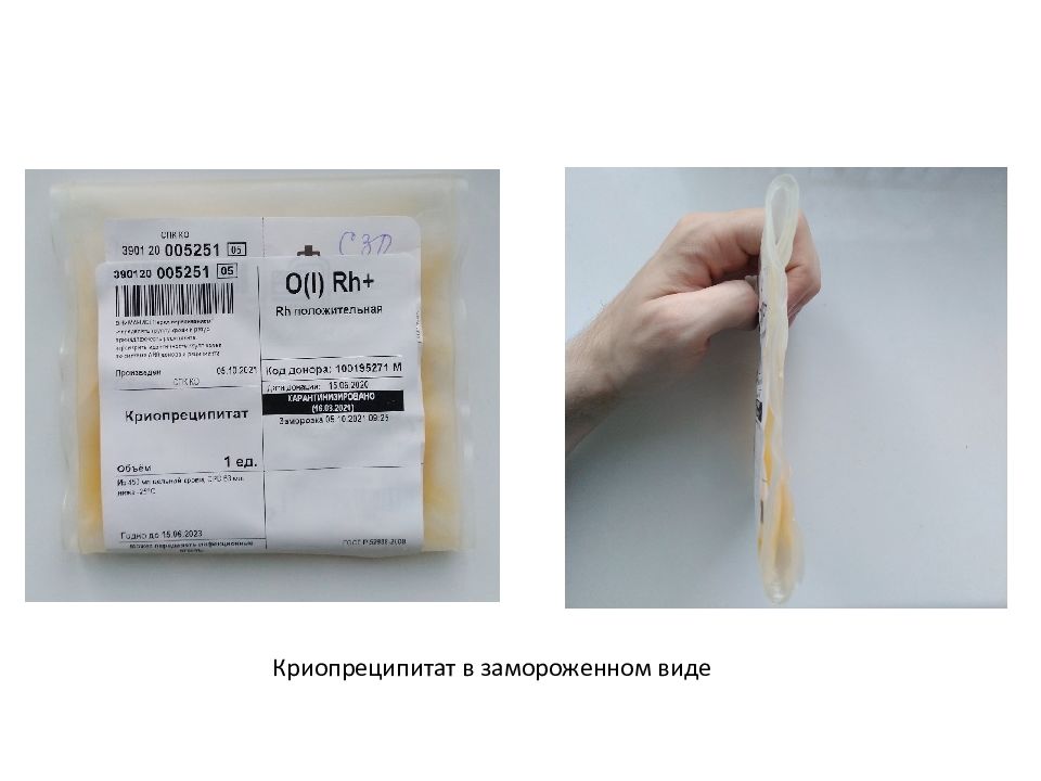Криопреципитат инструкция. Криопреципитат. Криопреципитат показания. Криопреципитат инструкция по применению.