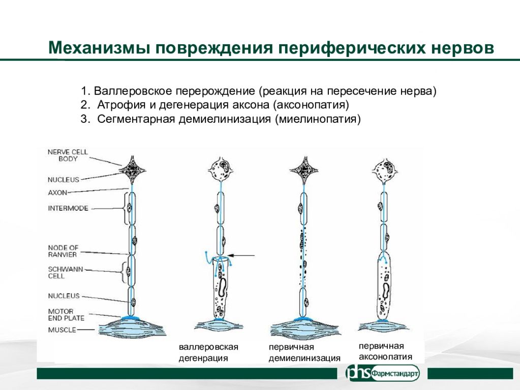 Купирование нервов. Механизмы повреждения периферических нервов. Валлеровское Перерождение нервных волокон. Сегментарная демиелинизация. Валлеровское Перерождение.