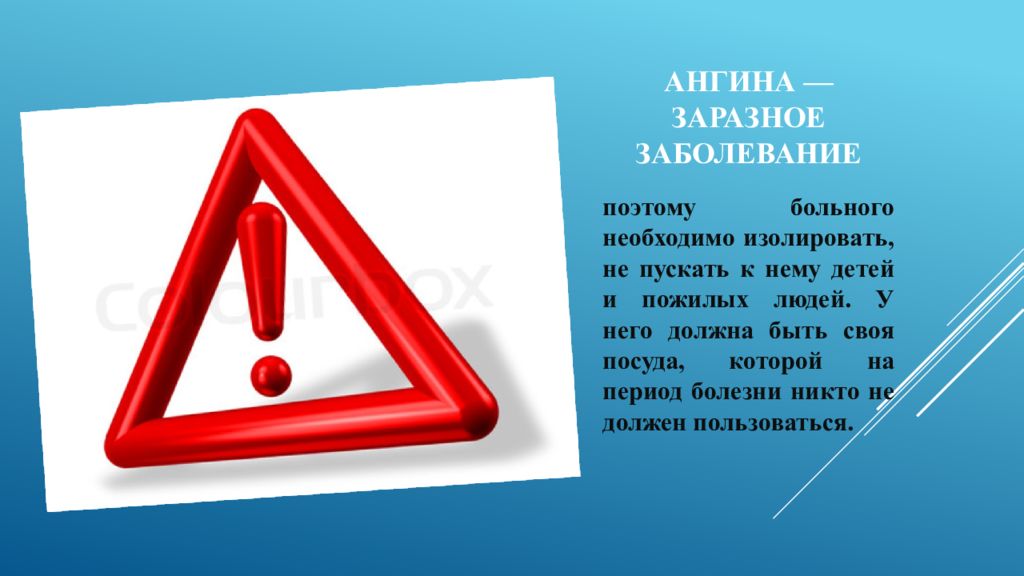 Сообщение о болезни ангина. Слово ангина. Катаральная ангина у взрослых. Вторичные ангины классификация. Ngina.