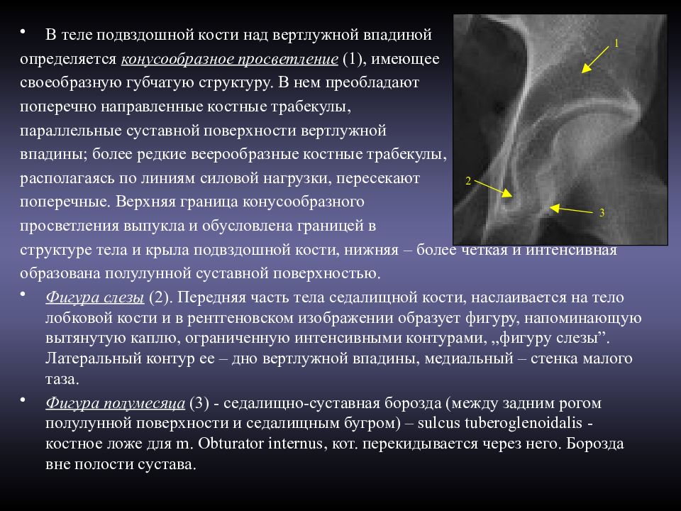 Единичное кистовидное просветление. Анатомия подвздошной кости кт. Крыло подвздошной кости рентгенограмма. Подвздошная кость рентген анатомия.