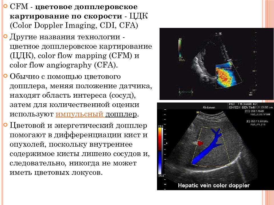 Цдк в узи гинекологии. Допплеровское картирование. Цветовое допплеровское картирование в гинекологии. Цветовое и энергетическое допплеровское картирование. Цветное допплеровское картирование (ЦДК).
