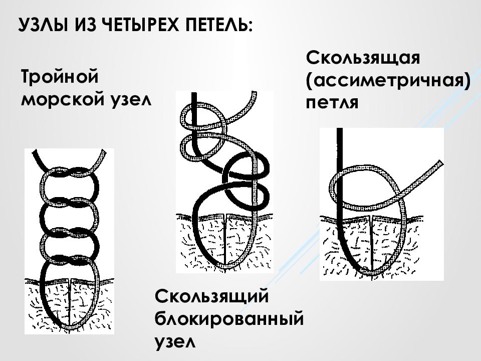 Хирургический узел схема