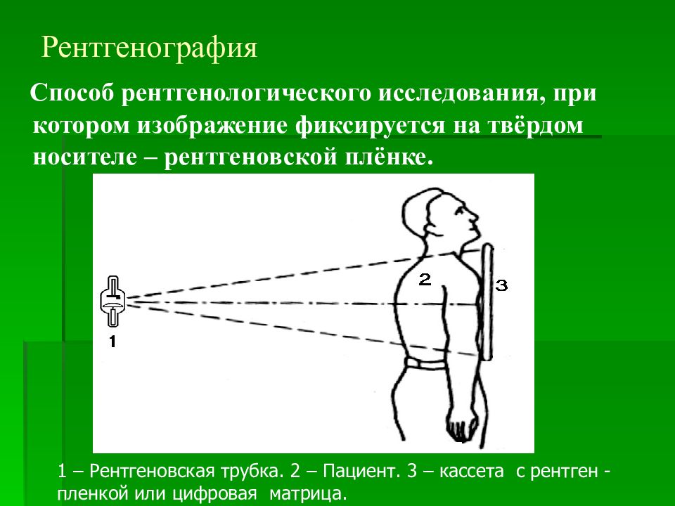 Методика получения рентгеновского изображения