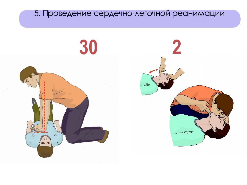 Проведение сердечно легочной реанимации. Порядок выполнения сердечно-легочной реанимации. Порядков проведения сердечно-легочной реанимации. Техника проведения СЛР 30:2. Алгоритм проведения сердечно-легочной реанимации.2.