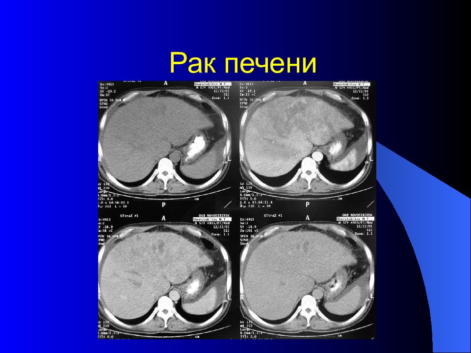 Лучевая диагностика брюшной полости презентация