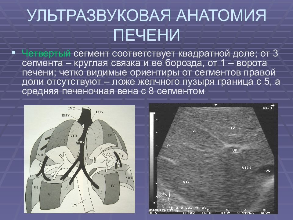 Сегменты печени на узи схема