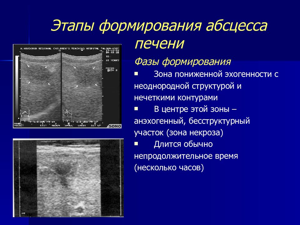 Пониженная эхогенность печени