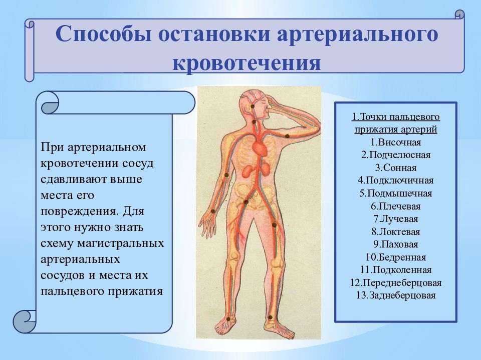 Способ остановки артериального. Точки прижатия артерий для остановки артериального кровотечения. Артериальное кровотечение точки прижатия артерии. Места прижатия артерий при кровотечениях. Артериальное кровотечение из сосудов нижних конечностей.