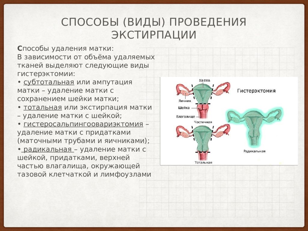 Приходить матка. Ампутация и экстирпация матки. Экстирпация и надвлагалищная ампутация матки. Экстирпация матки с придатками.