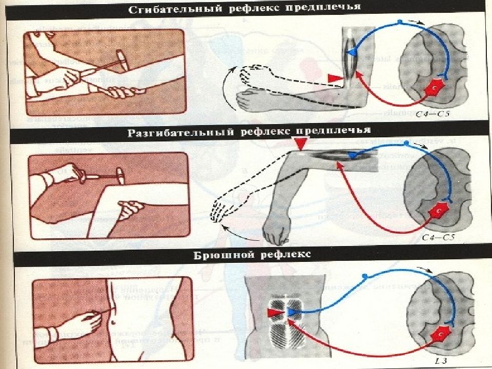 Брюшной рефлекс рисунок