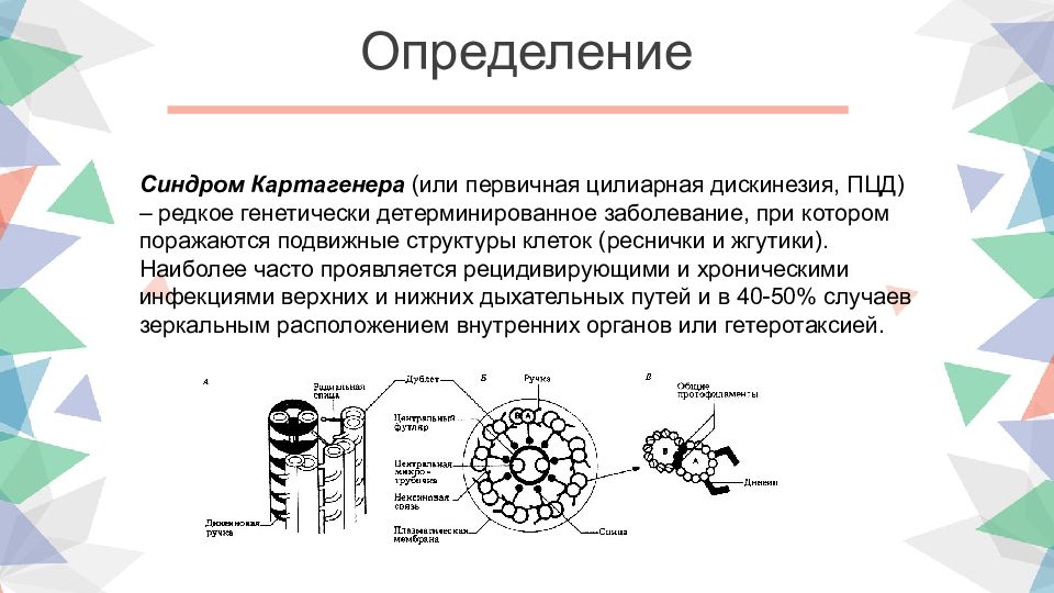 Синдром картагенера презентация