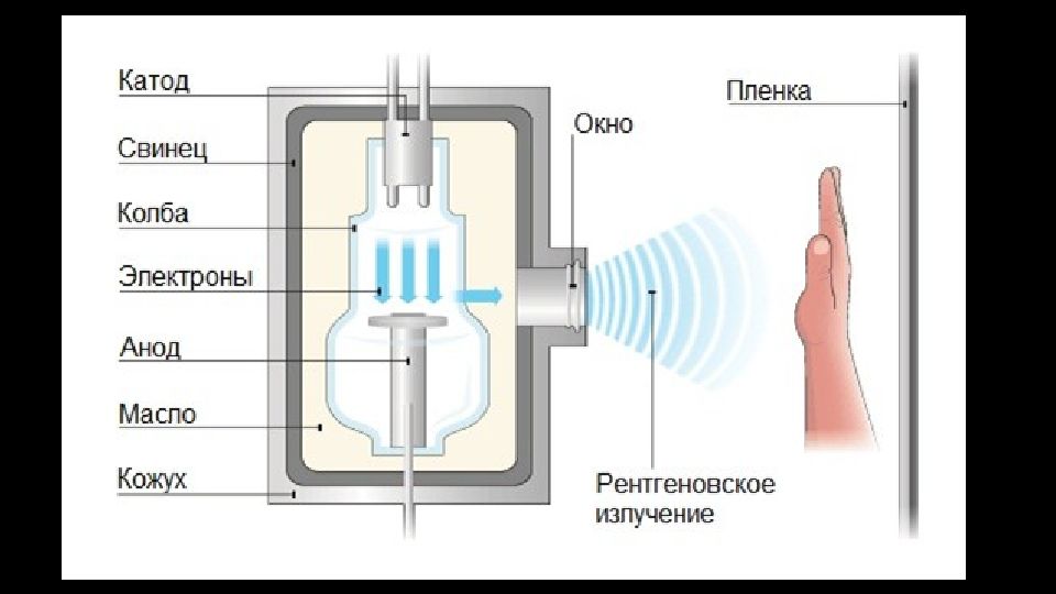 Катод телефон. Защитный кожух рентгеновской трубки. Катод и анод в рентгеновской трубке. Рентгеновская трубка рентген аппарата. Рентгеновская трубка с прострельным анодом.