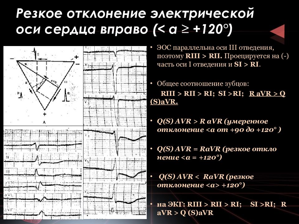 Электрическая ось сердца