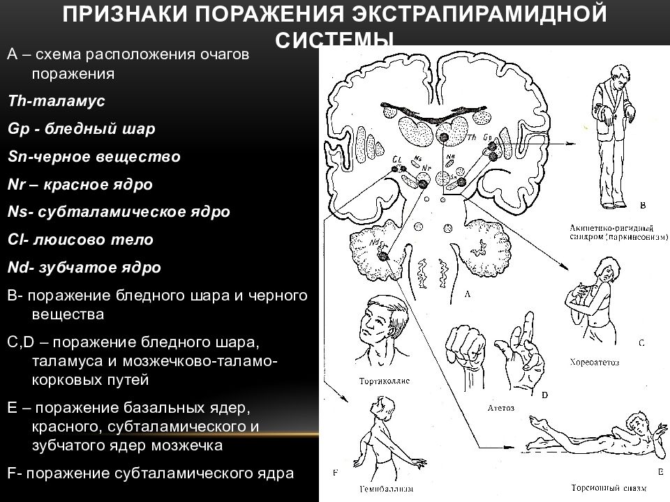 Экстрапирамидная система неврология презентация