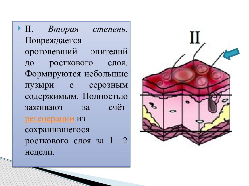 Вторая стадия