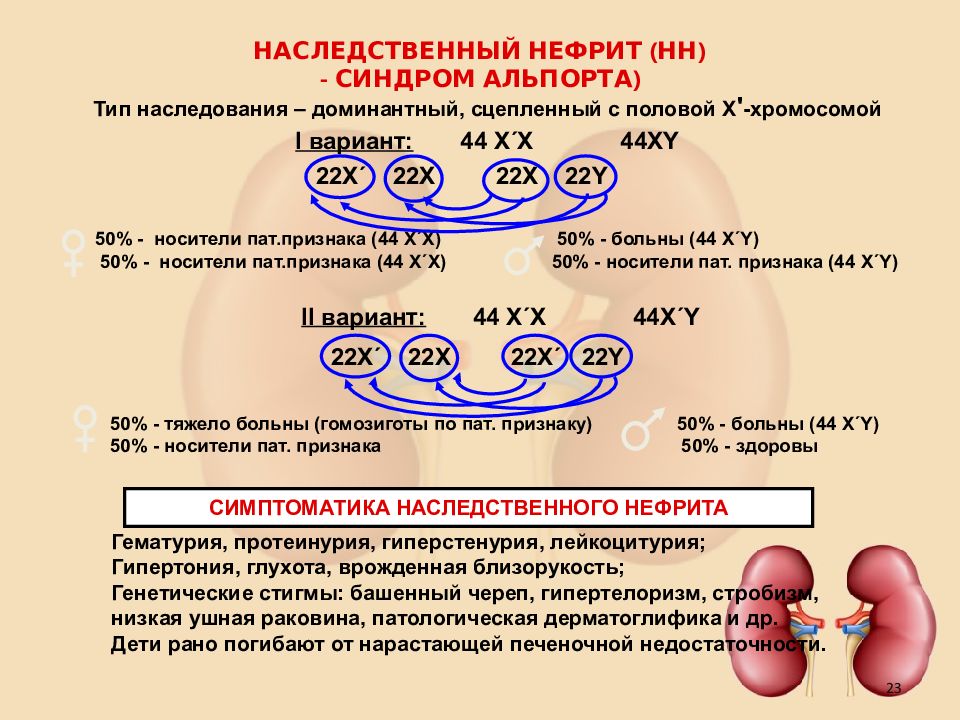 Синдром альпорта у детей фото