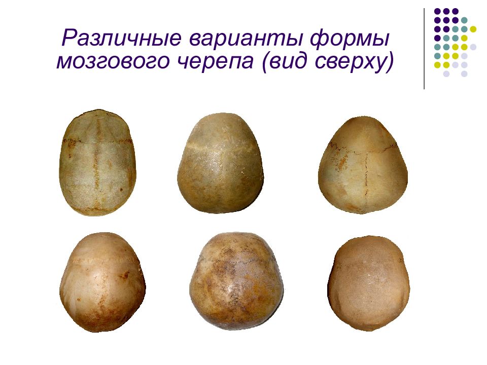 О чем говорят формы черепа. Форма черепа. Какие бывают формы черепа у человека.