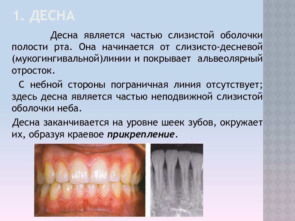 Строение десны человека фото с описанием