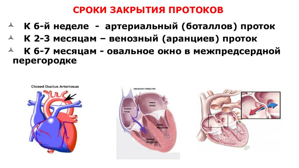 Открыто овальное окно у сердце ребенка