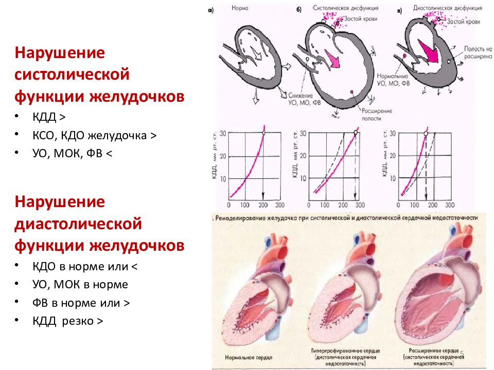 Диаграмма давления и объема крови для желудочков сердца