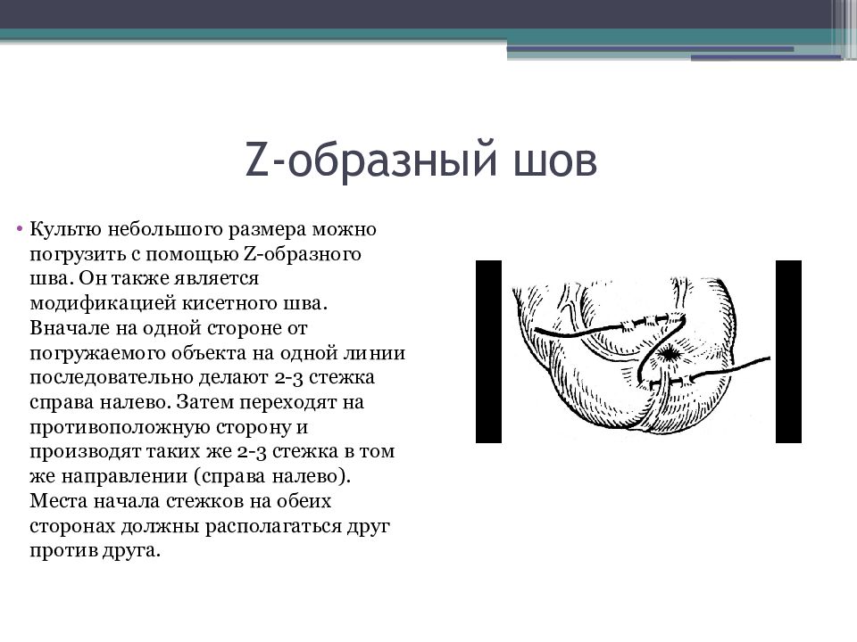 Кишечный шов презентация