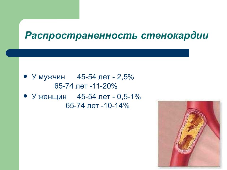 Стенокардия 2 степени. Распространенность стенокардии. Презентация на тему стенокардия. Реферат на тему стенокардия. Буклет на тему стабильная стенокардия напряжения.