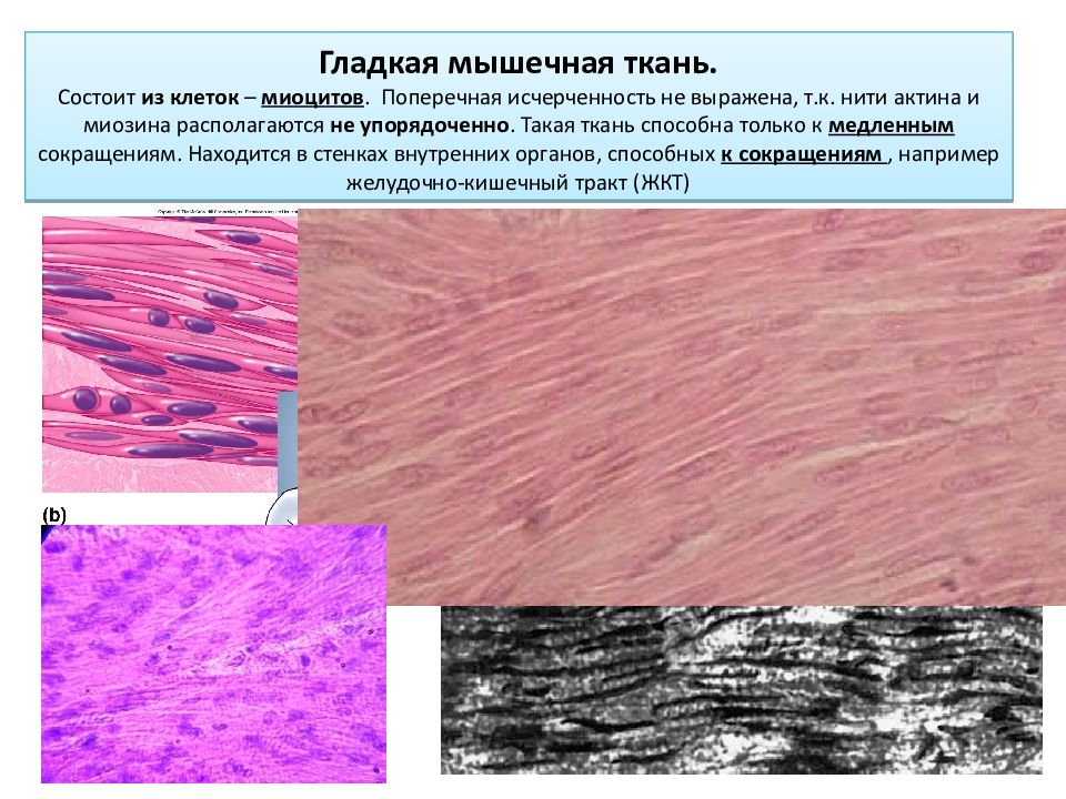 Двигательная ткань. Мышечная ткань миоциты. Гладкая мышечная ткань ув 600. Гладкая мышечная ткань микропрепарат. Поперечная исчерченность мышечной ткани.