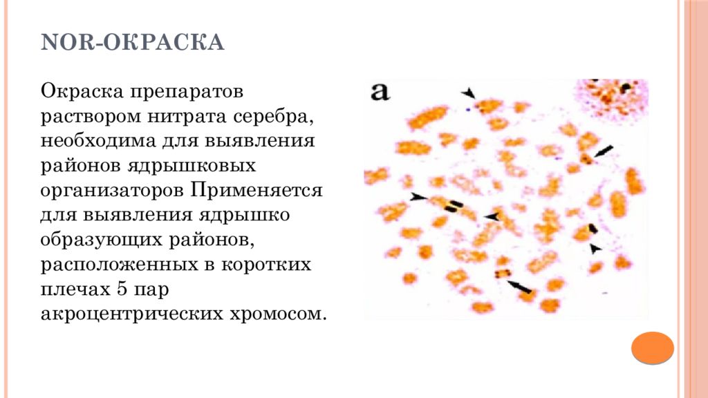 Изменение окраски хромосом. Метод дифференциальной окраски хромосом. Дифференциальное окрашивание хромосом. Методы окрашивания хромосом. Монохромное окрашивание хромосом.