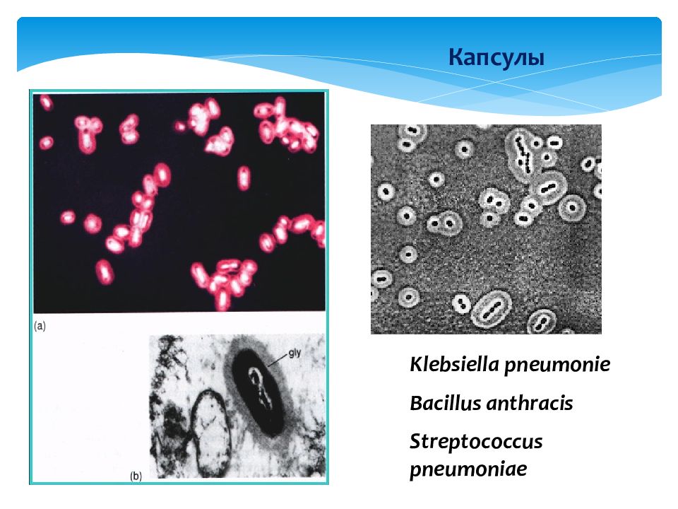 Klebsiella pneumoniae презентация