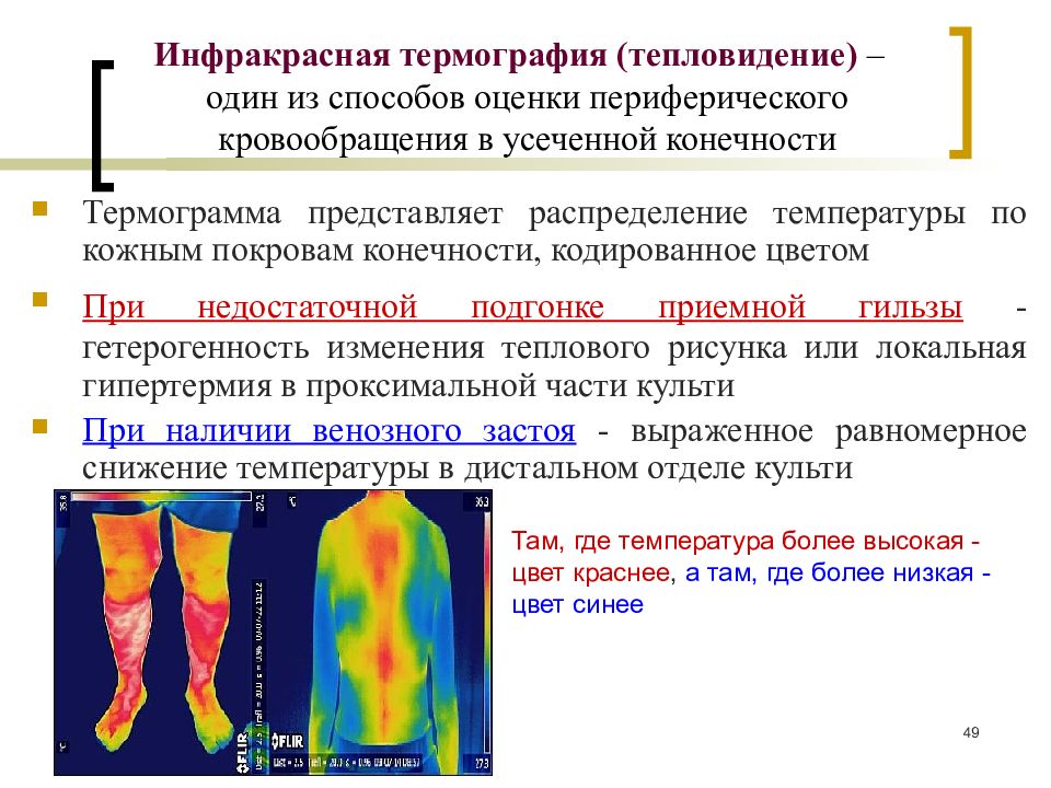 Характеристики теплового излучения термография презентация