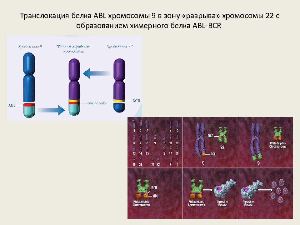 9 хромосома. Транслокация(v;11q23);. Транслокация BCR. Транслокация 22 хромосомы. Транслокация 6 и 9 хромосом.