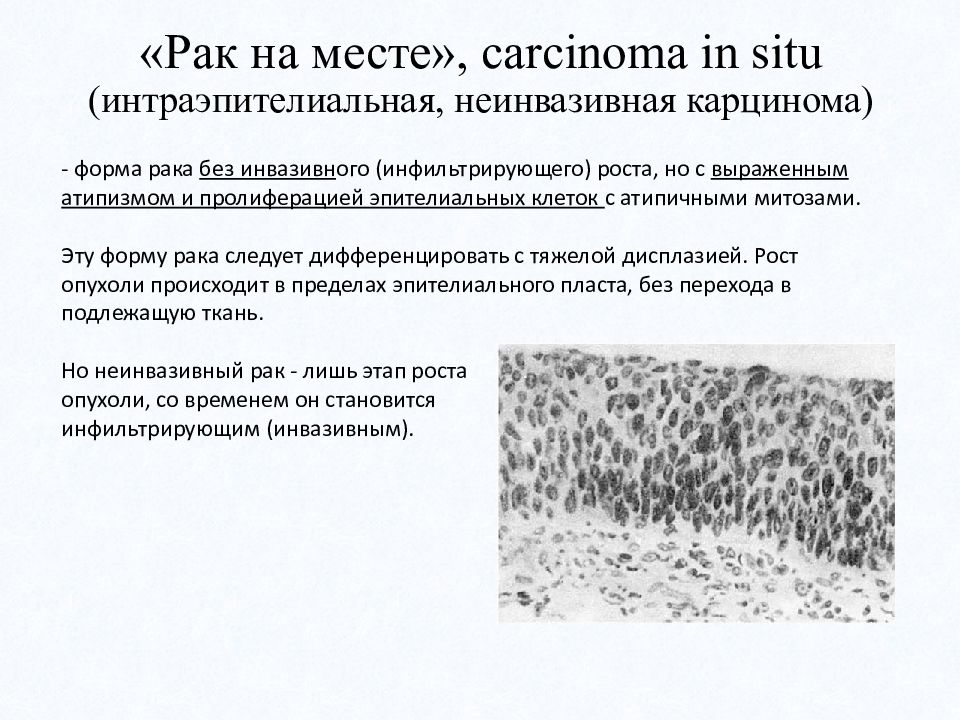 Интраэпителиальные поражения и злокачественные