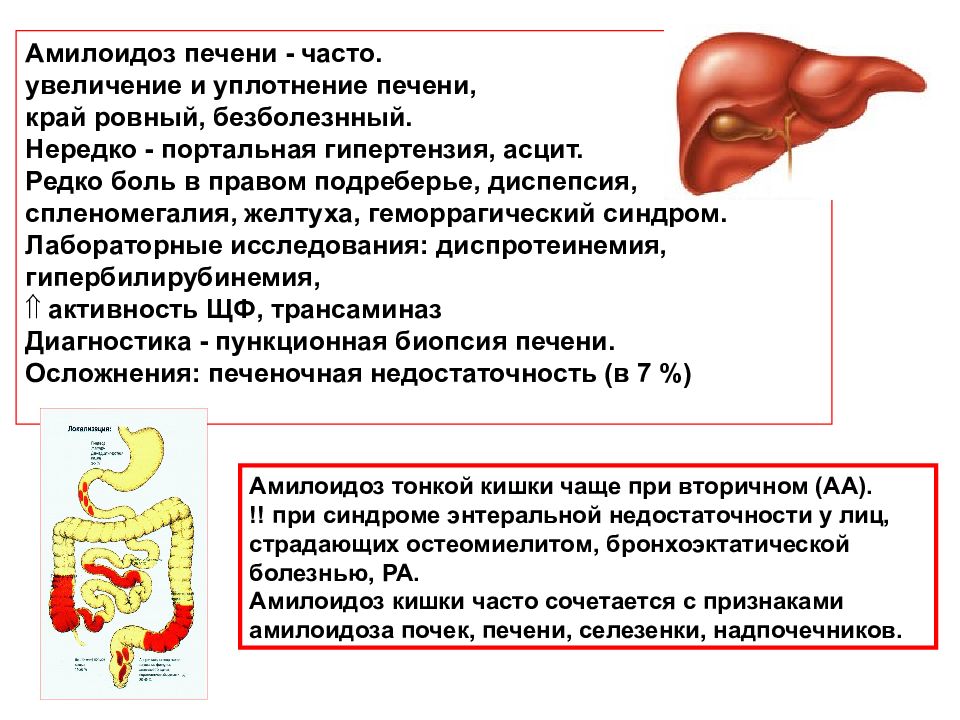 Амилоидоз печени презентация