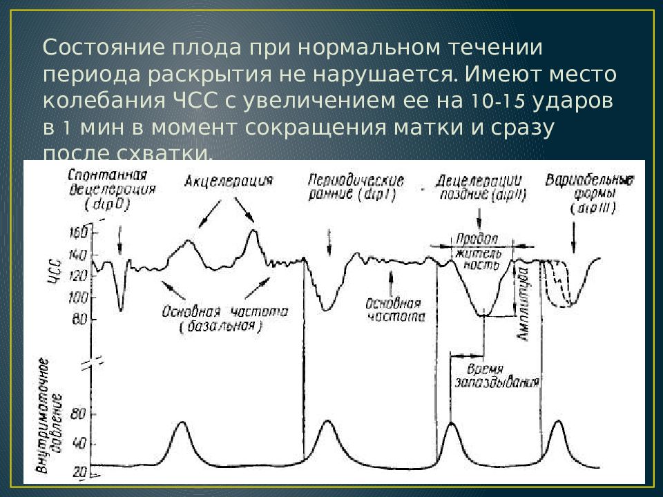 Осцилляция ктг