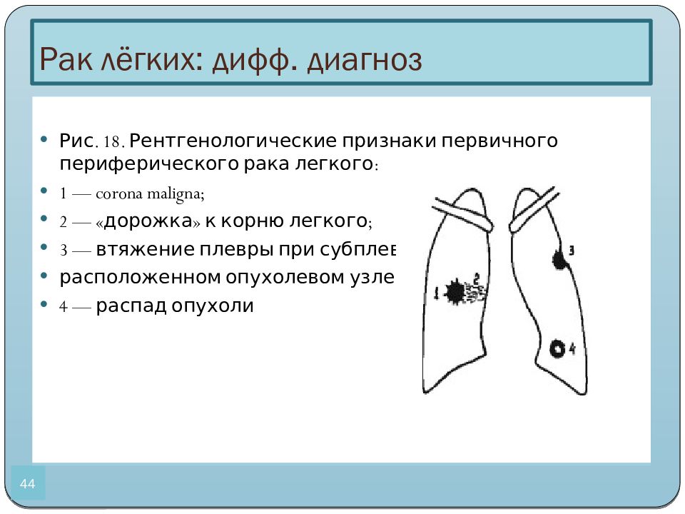 Рак легкого диагностика презентация