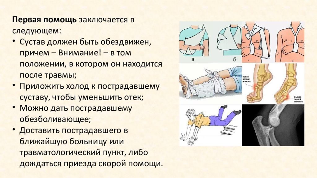 Первая помощь при переломах презентация 8 класс