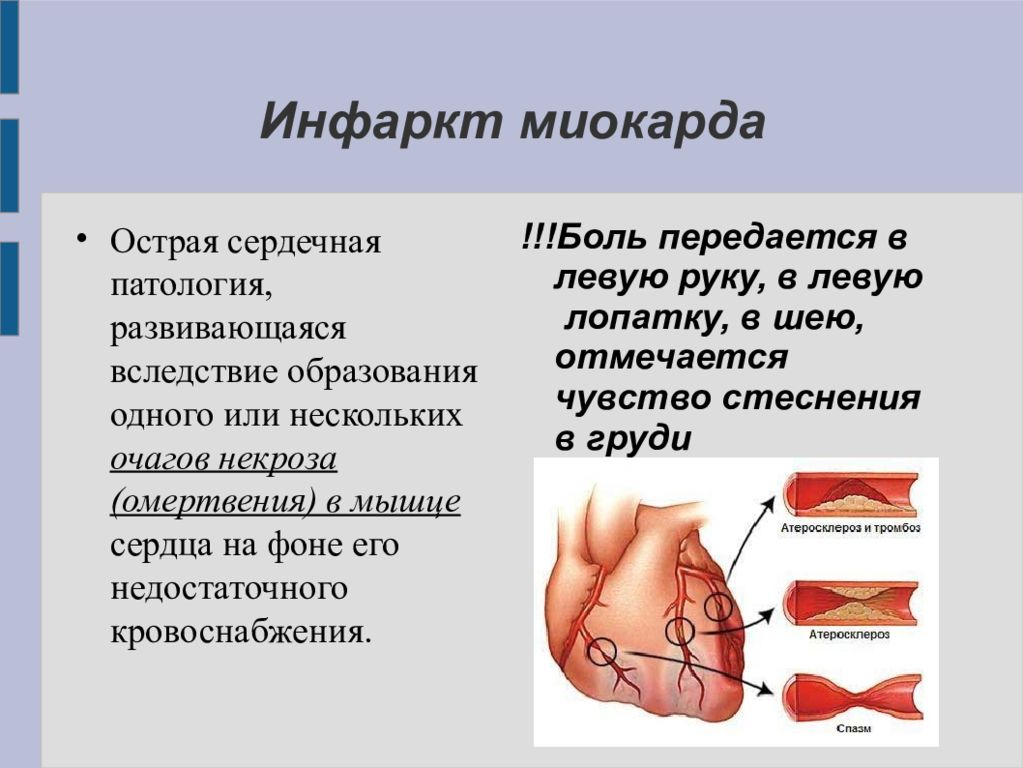 Презентация на тему сердечно сосудистые заболевания 8 класс