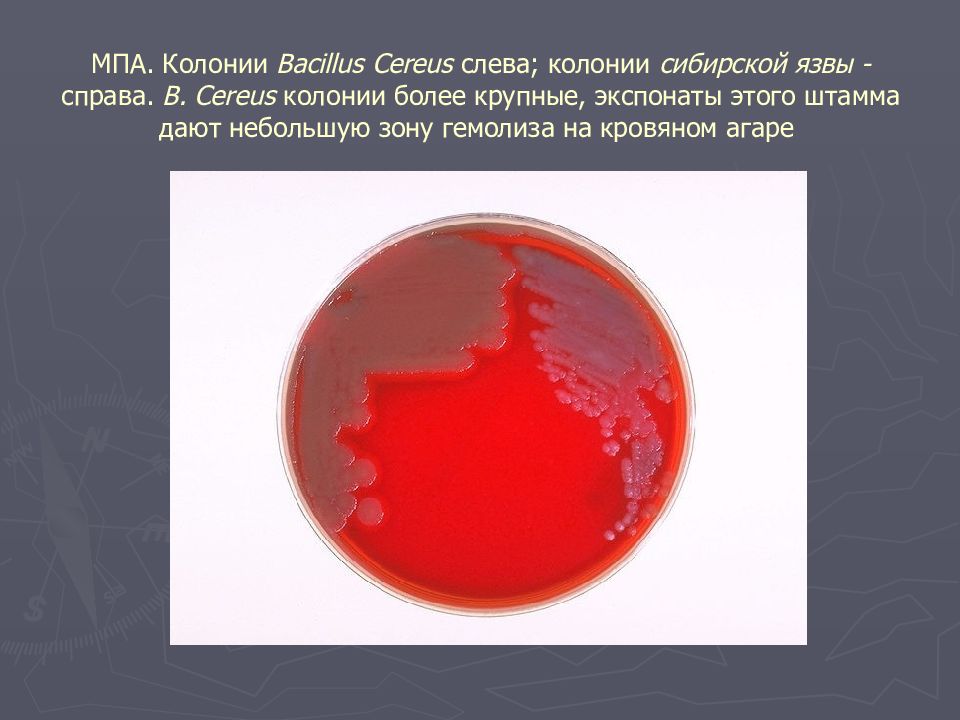 Bacillus anthracis Сибирская язва. Сибирская язва на мясопептонном агаре. Bacillus anthracis колонии на агаре. Сибирская язва на кровяном агаре.