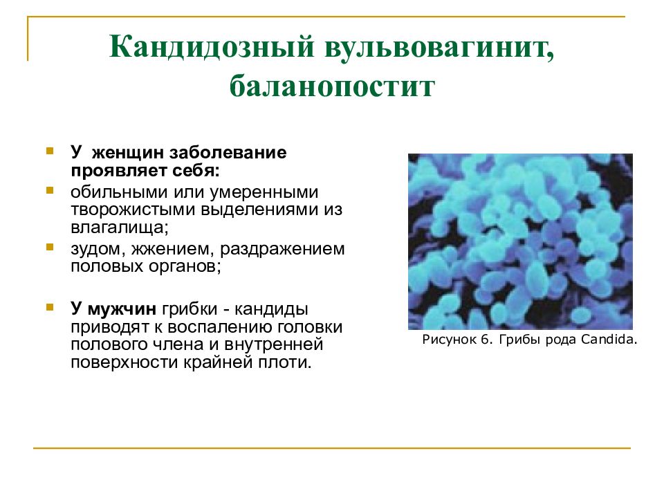 Кандидозный вульвовагинит. Кандидозный баланопостит лекарства. Кандидозный баланопостит у мужчин. Кандидозный вульвовагинит, баланит и баланопостит.