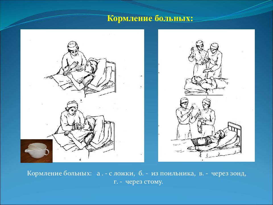 Кормление тяжелобольного пациента