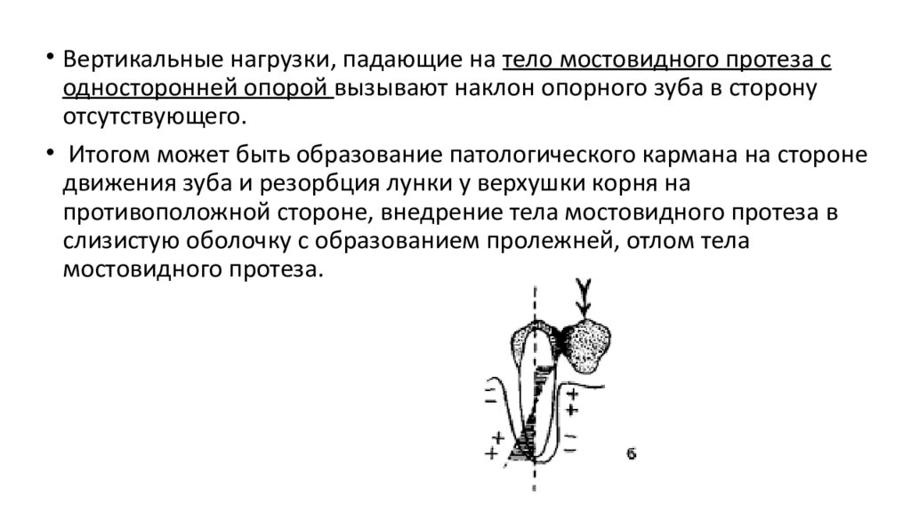 Показания к применению мостовидных. Показания к применению мостовидных протезов. Показания к изготовлению мостовидных протезов. Принципы конструирования мостовидных протезов. Показания и противопоказания для мостовидного протеза.