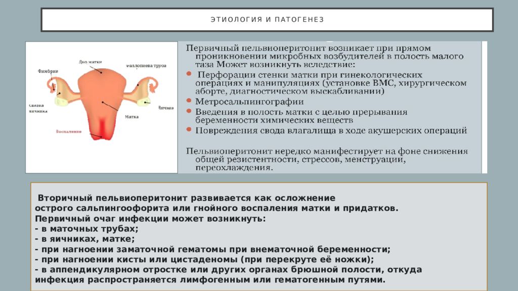 Клиническая картина пельвиоперитонита