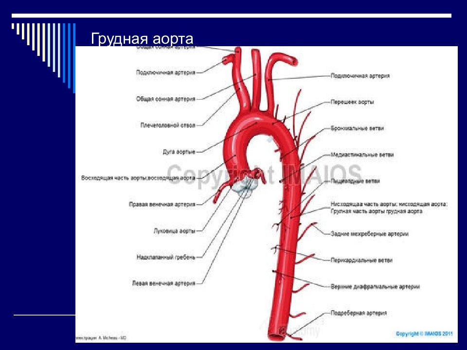 Анатомия аорты. Ветви грудной аорты анатомия. Ветви грудной части аорты. Париетальные ветви грудной аорты. Топография внутренней грудной артерии схема.