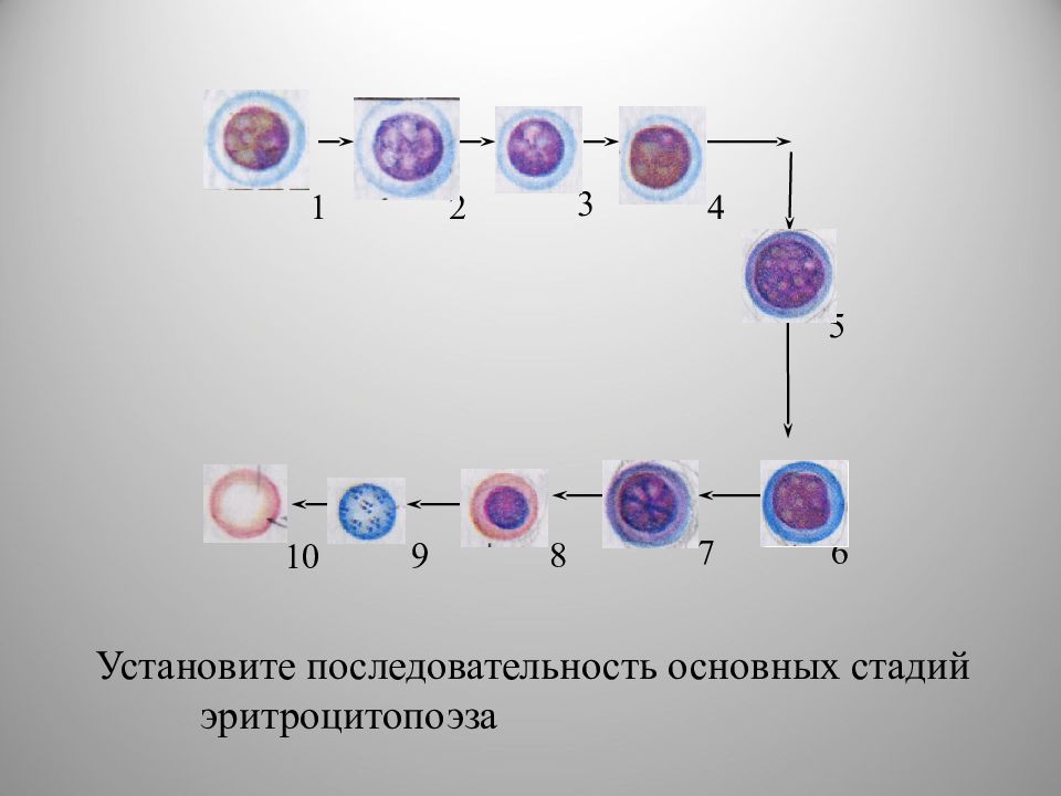 Эритробласт. Оксифильный нормобласт. Эритробласты. Оксифильный проэритробласт. Проэритробласт (эритробласт).