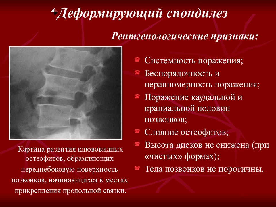Причина костного заболевания. Рентгенодиагностика заболеваний костей и суставов. Рентгенодиагностика патологии костей. Болезнь разрушение костей название.