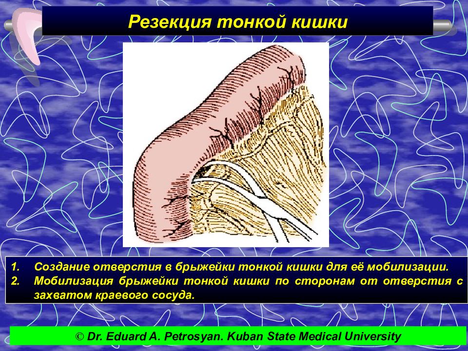 Презентация по тонкой кишке