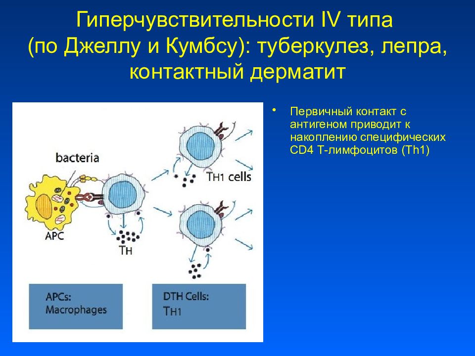 Реакция кумбса. 4 Тип гиперчувствительности иммунология. Гиперчувствительности по Джеллу и Кумбсу. Гиперчувствительность классификация по Джеллу и Кумбсу. Реакция гиперчувствительности 4 типа механизм.